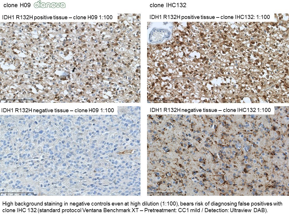 Clone H09 is the goldstandard for anti-IDH1 R132H IHC, which is recommended by the CNS WHO classification.
